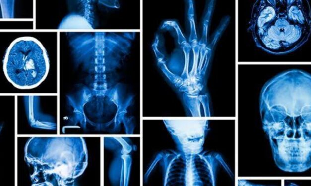 Naranjos: Día Nacional de la Radiología
