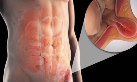 Mecatlán: Cirugías de Hernia y Vesícula