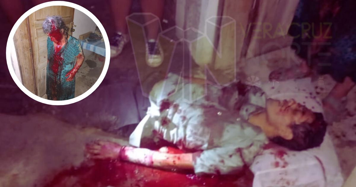 Trágica noche en Citlaltépetl: Violenta disputa por herencia deja heridos y destierro