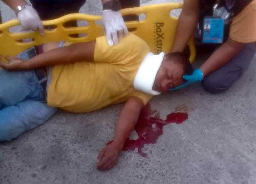 Álamo: Se cae «EL CHON»