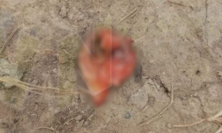 Álamo: Hijo cercena la nariz a su padre en violenta riña familiar