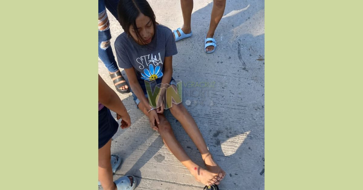 Potrero del Llano: Perro se le cruza y motociclista de 14 años termina en el hospital