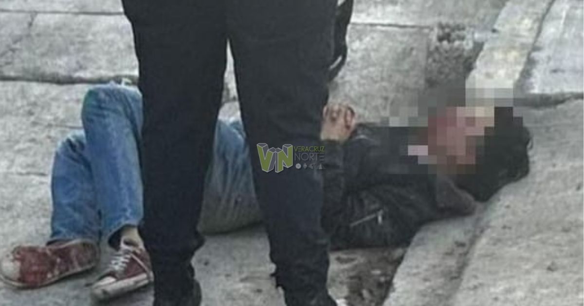 Álamo: Menor de edad hospitalizado tras derrapar en motocicleta