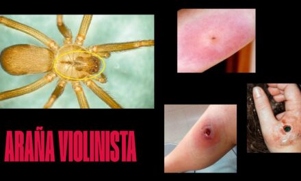 El Dato del Día: ¿Sabes identificar a la araña violinista?