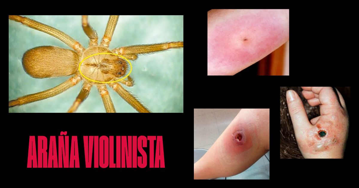 El Dato del Día: ¿Sabes identificar a la araña violinista?