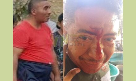 Álamo: Hombre con problemas mentales hiere a un vecino en  Exhacienda Alazán