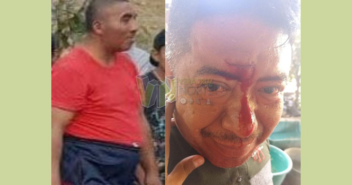 Álamo: Hombre con problemas mentales hiere a un vecino en  Exhacienda Alazán