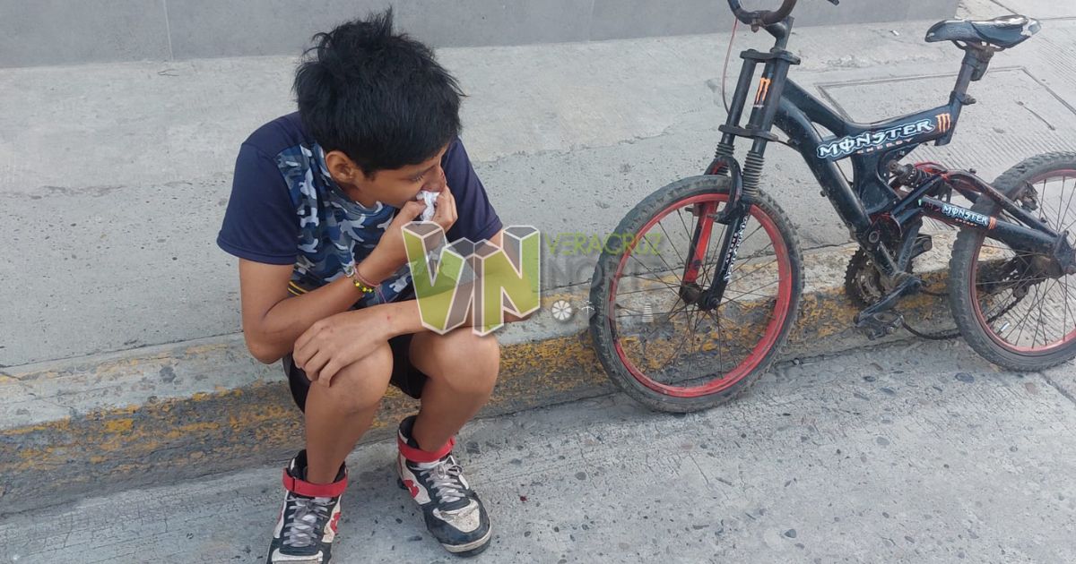 Accidente de bicicleta en Álamo: menor cae y se lesiona