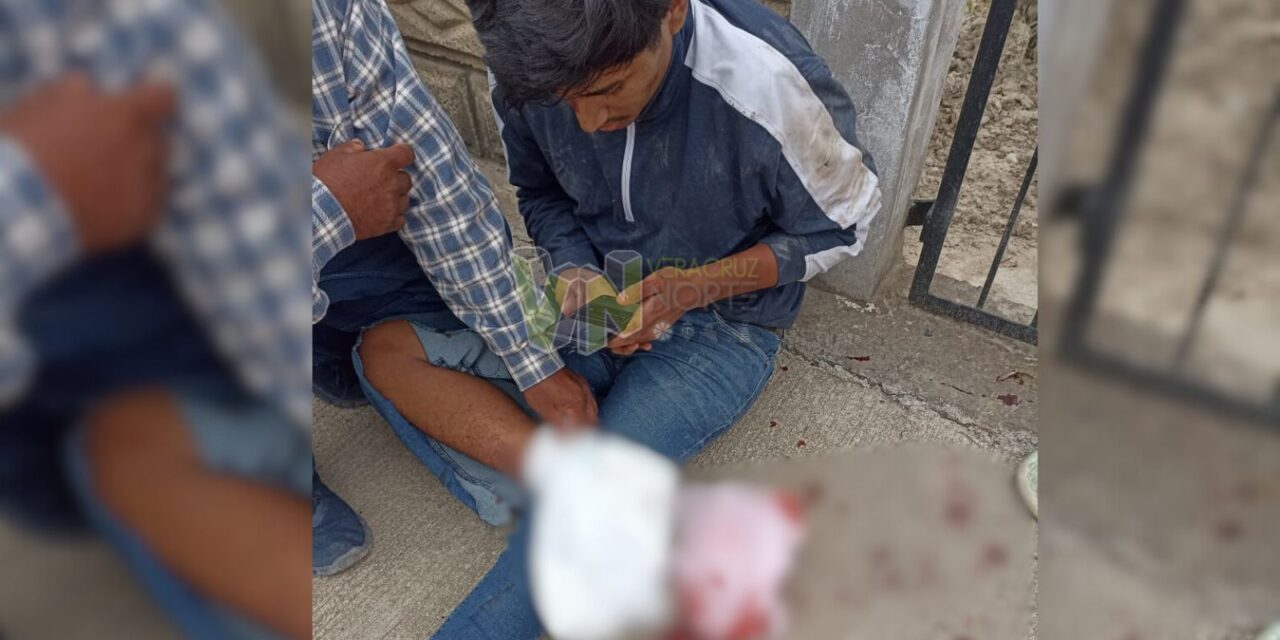 Evita un choque y termina en grave lesión en Álamo: Joven derrapa y sufre desgarro en el pie