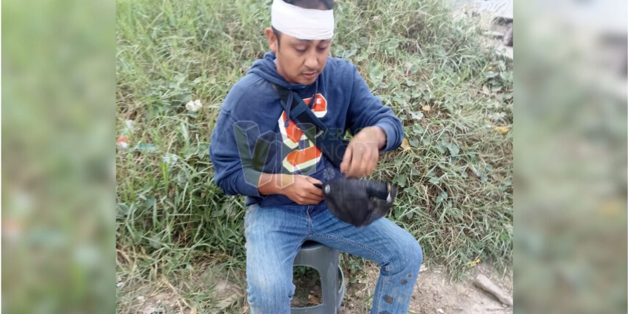 Álamo: Motociclista derrapa en el Bulevar Quintana Roo