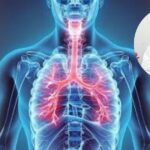 Álamo: Siete de cada diez pacientes en Salud Municipal presentan cuadros respiratorios